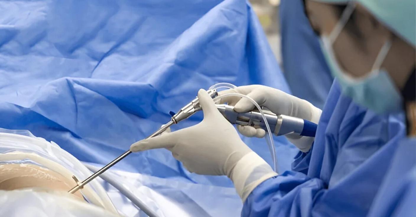 How Endoscopic Spine Surgery Is Transforming Patient Outcomes