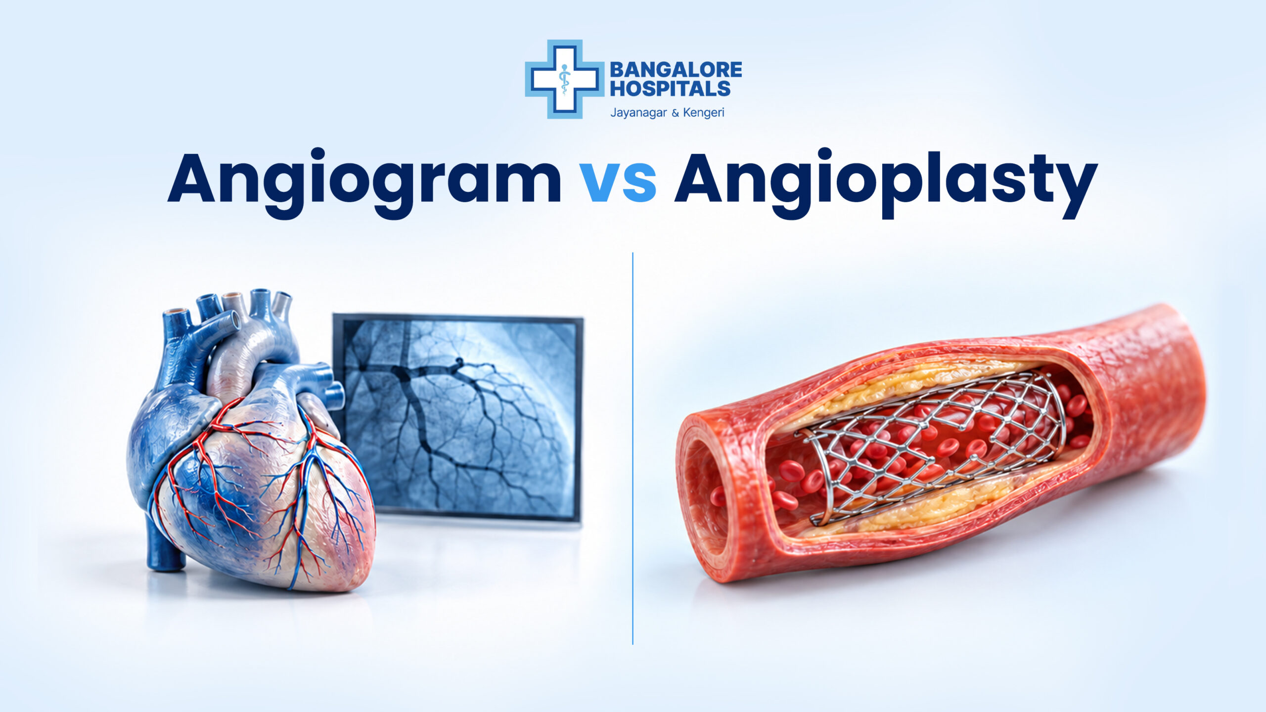 Angiogram vs. Angioplasty – What’s the Difference?